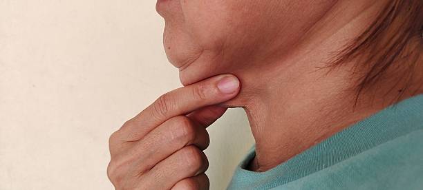 Double Chin Removal in Abu Dhabi